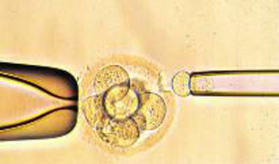 Fig.02